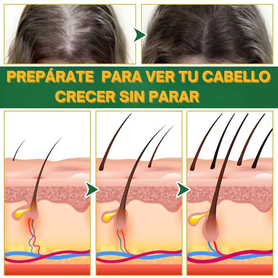 OUHOE-CRECIMIENTO DE CABELLO